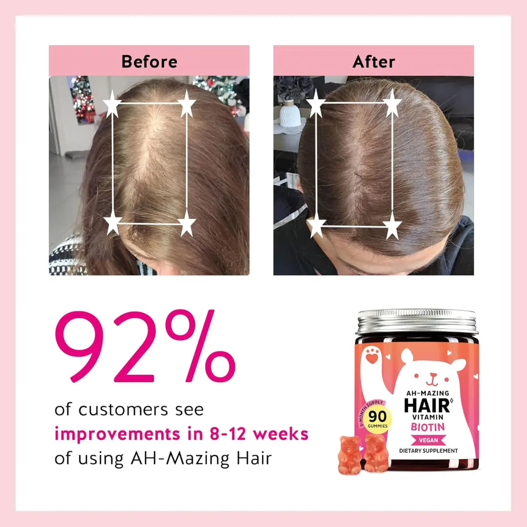 Rainlyx Biotin Hair Growth Gummies — Less Hair Loss, More Confidence