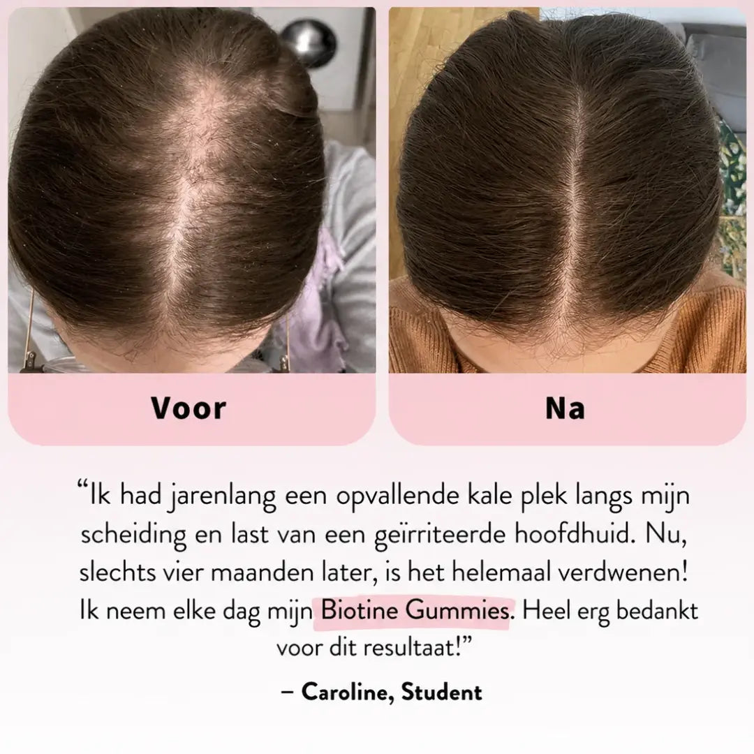 Rainlyx Biotine Haargroei Gummies — Minder Haaruitval, Meer Zelfvertrouwen